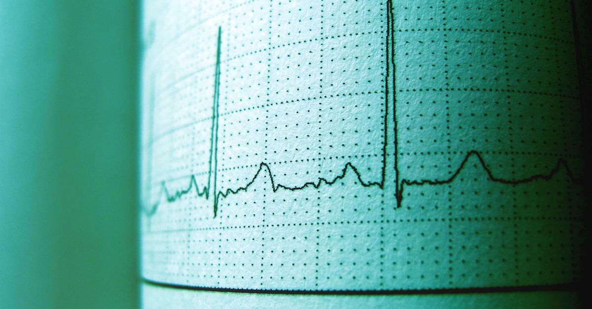 Close-up of an ECG printout displaying heartbeat rhythm and frequency for medical analysis.